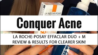 Ultimate Review La Roche Posay Effaclar Duo M Unveiled  Is it Worth the Hype [upl. by Elatsyrk]