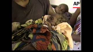 Malnutrition crisis among people from war zones [upl. by Nileve]