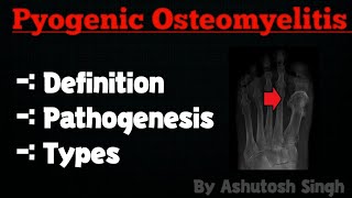 OSTEOMYELITIS Pathology [upl. by Bradlee]