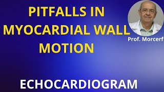 Tips for Better LV Endocardial Identification [upl. by Kieryt]