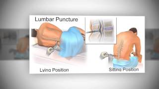 Lumbar Puncture LP [upl. by Einohtna]