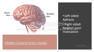 Syphilis neurosyphilis [upl. by Defant]