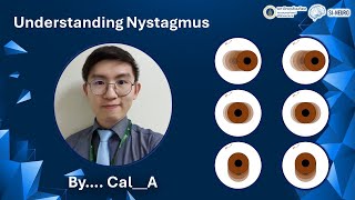 Understanding Nystagmus by KL  May 21st 2024 [upl. by Voltz]