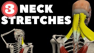 Neck Stretches for Instant pain relief [upl. by Atiuqcir]