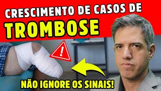 TROMBOSE SINAIS E SINTOMAS QUE VOCÊ NÃO PODE IGNORAR Dr Alain Dutra [upl. by Omura]