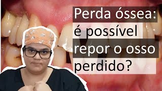 Como recuperar o osso perdido na perda óssea periodontite  Dra Bianca Rosa [upl. by Nanerb733]