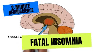 2Minute Neuroscience Fatal Insomnia [upl. by Allesig]