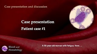 Patient case presentation case 1 [upl. by Joung]