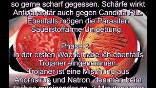 Gegen Parasiten Teil 2 MicroorganismenPilze Borrelien Würmer das Leben schwer machen [upl. by Edythe]