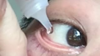 How To Use Eye Ointment [upl. by Adelheid]