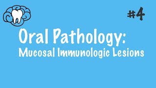 Oral Pathology  Mucosal Immunologic Diseases  INBDE ADAT [upl. by Erickson]