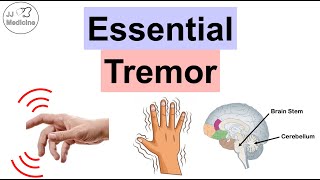 Essential Tremor  Causes Pathophysiology Symptoms Exacerbating Factors Diagnosis Treatment [upl. by Sarajane]