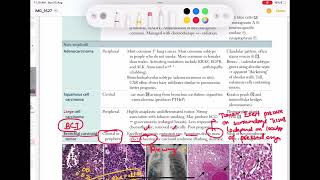 Bronchial Carcinoid tumor Respiratory 56  First Aid USMLE Step 1 in UrduHindi [upl. by Yajet]