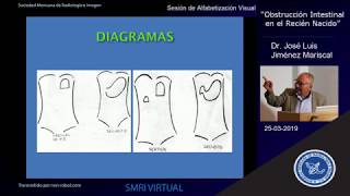 Sesión de Alfabetización Visual en Radiología Obstrucción intestinal en el recién nacido [upl. by Kannan327]