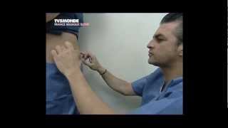 Lipolyse de labdomen par le Docteur Thierry LAFITTE TV5 Mondemp4 [upl. by Ahteral]