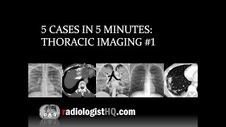 5 Cases in 5 Minutes Thoracic 1 [upl. by Milman]