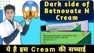 यह है इस क्रीम की सच्चाई  Betnovate n cream awearness  Betnovate n cream [upl. by Caraviello]