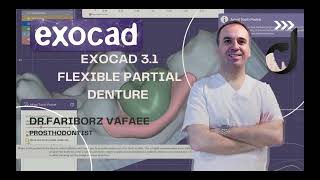 how to design flexible partial denture in exocad31rijkapart2 [upl. by Nyberg]