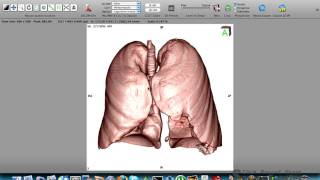 OSIRIX Demo  Tutorial VR Volume Rendering 3D LungPulmão [upl. by Netsuj]