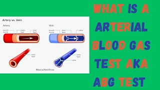 What is a arterial blood gas test AKA ABG TEST [upl. by Aroz]