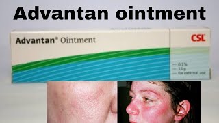 Advantan ointment  Use  Side Effects  Benefits  price review skincare beauty [upl. by Luke]