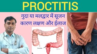 Proctitis cause sumptomsamp homoeopathic medicineProctitis best medicines drkailashprasad [upl. by Erlandson]