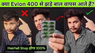 Evion 400 Vitamin E Capsules for Hair  How to Use Vitamin E Capsule for hair Growth amp Hair Fall [upl. by Ardnoid105]