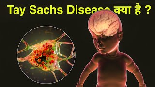 Tay Sachs Disease क्या हैं [upl. by Marje384]