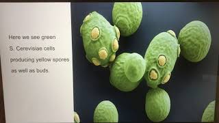 Saccharomyces Cerevisiae Presentation [upl. by Nageem]