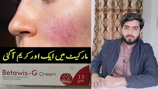 Betawis G Cream Review  Usage amp Side Effects  Skin Redness  Beauty Facts [upl. by Navlys999]