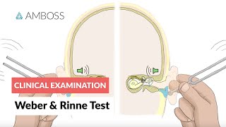 Weber and Rinne Test  Clinical Examination [upl. by Eivad]