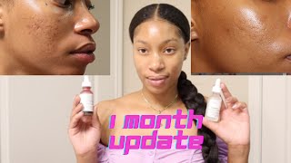 1 MONTH SKIN UPDATE USING THE ORDINARY SKINCARE II REVIEW for acne acne scars dark marks [upl. by Sinegold]