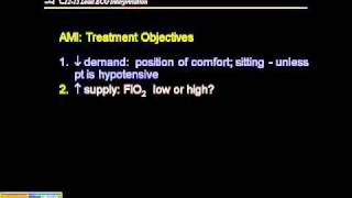 1215 ECG Management of MI [upl. by Phare]