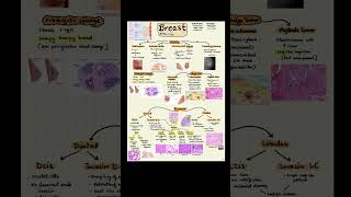 Breast pathology notes Breast cancer Short note  Fibroadenoma of breast [upl. by Donia]