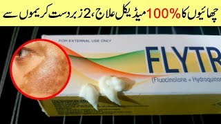 Remove Freckles amp Melasma on Face with Hyderquin Plus amp Flytro Cream Urdu Hindi [upl. by Alfonso]