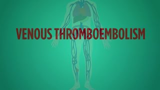 Venous Thromboembolism Explained in 60 Seconds [upl. by Nurse881]