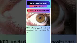 Kayser Fleischer Ring Image Based Important Question🙋 Norcet 8 ytshorts [upl. by Andris532]