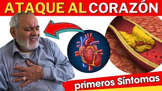 💔 SINTOMAS de INFARTO en Mujeres y Hombres ATAQUE AL CORAZÓN [upl. by Joachima]