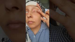 No eyelashes dayeyelashes in chemotherapychemotherapy and hairfall cancer chemotherapy [upl. by Oinotnanauj534]