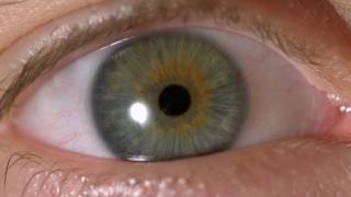 My Iris Wobbles  Eye In Slow Motion [upl. by Refannej]