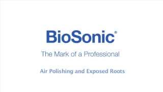 BioSonic Suvi Air Polishing and Exposed Roots [upl. by Chil]