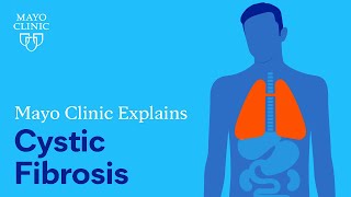 Mayo Clinic Explains Cystic Fibrosis [upl. by Hebel626]