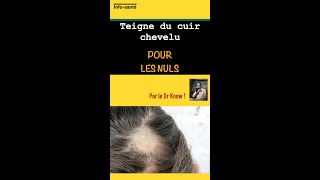 Teigne du cuir chevelu pour les nuls [upl. by Akinat956]