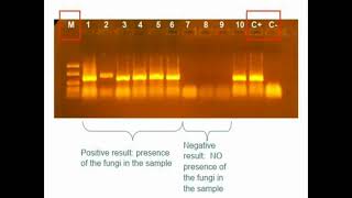 Final Product of PCR in Agarose Gel Electrophoresis [upl. by Nuahsal470]