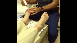 Laser treatment for toenail fungus [upl. by Orabelle]