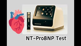 NTProBNP test  Cardiac Marker STANDARD™ F [upl. by Leiva]