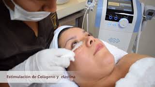 Rejuvenecimiento Facial  Exilis Ultra [upl. by Bigner]