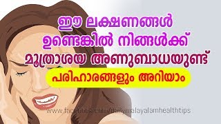 Urinary Infection Symptoms Diagnosis and Treatment  Daily Malayalam Health Tips [upl. by Nyvek496]