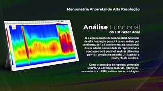 Você conhece nosso equipamento de Manometria de Alta Resolução de 24 Canais [upl. by Arch]