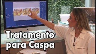 Tratamento para Caspa [upl. by Oicneconi]